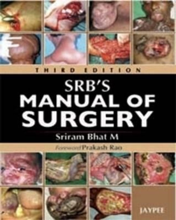 Srb Manual Of Surgery 3rd Edition Pdf